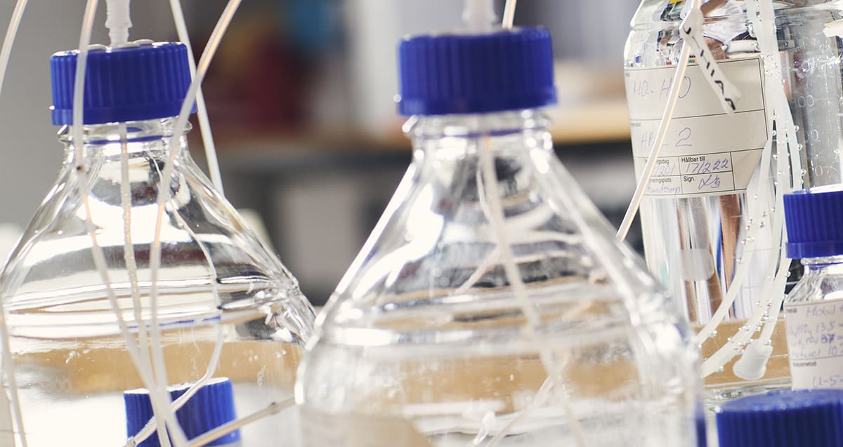 En ny forskningsstudie vid Akademiska sjukhuset visar att en mix av antikroppar i lederna har koppling till graden av inflammation och ledskada vid ledgångsreumatism, RA.