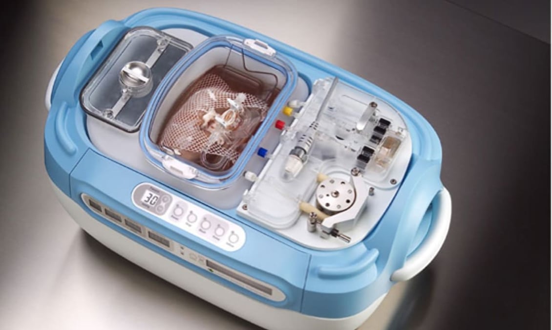 Efter organdonation förvaras den uttagna njuren i en perfusionsmaskin innan transplantationen. Njuren ligger i ett slutet system med kyld speciallösning där ett pulserande flöde genereras av maskinen.