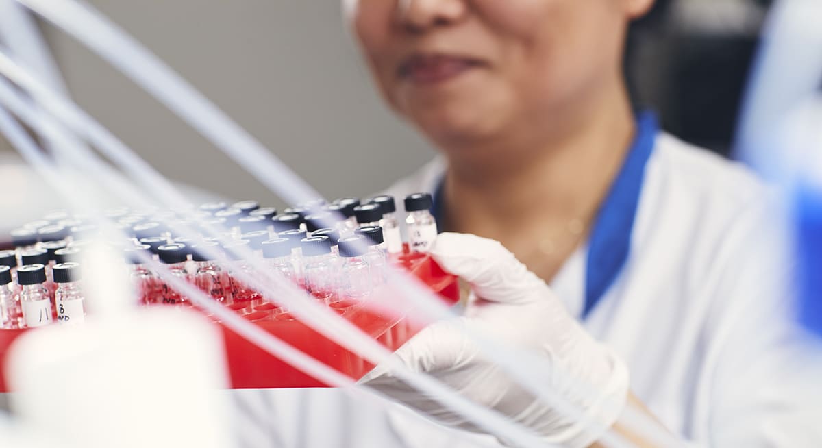 Nästa år startar en klinisk studie där man prövar immunterapi på väl utredda patienter med psykiska symtom orsakade av autoimmun sjukdom.