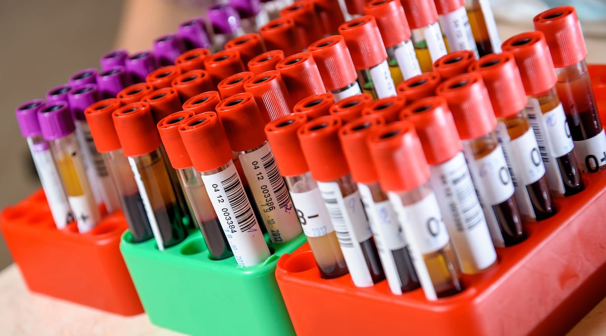 En studie ledd från Akademiska sjukhuset visar att det finns två tydliga undergrupper av patienter med Sjögrens syndrom som skiljer sig avseende genetisk bakgrund, förekomst av antikroppar och kliniska sjukdomsyttringar. Enligt forskare bör  man ta hänsyn till detta i läkemedelsstudier.