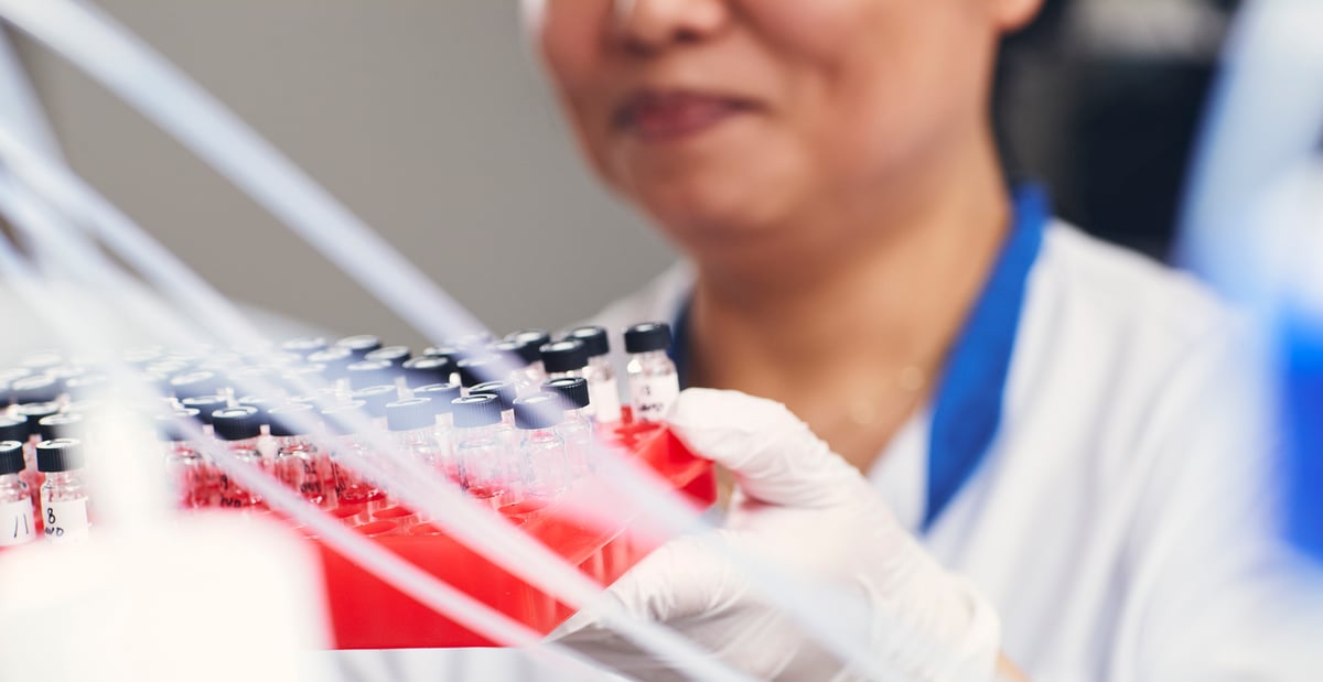 En studie vid Akademiska sjukhuset visar att personer med SLE som röker löper dubbelt så hög risk att drabbas av hjärtinfarkt jämfört med icke-rökare. För dem som ärvt en speciell genvariant, STAT4, från någon av sina föräldrar, innebär rökning en tredubblad risk.  Fotograf: Johan Alp