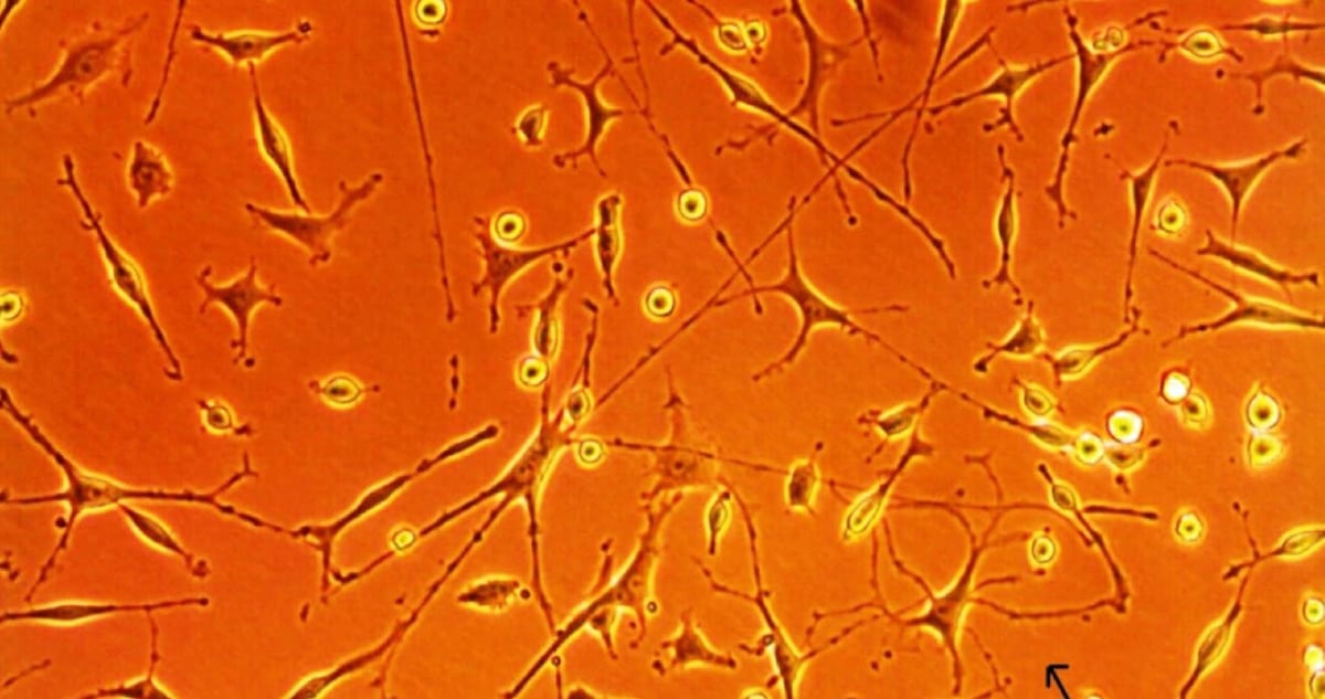 Hjärnceller hos en MS-sjuk person odlade i laboratorium.