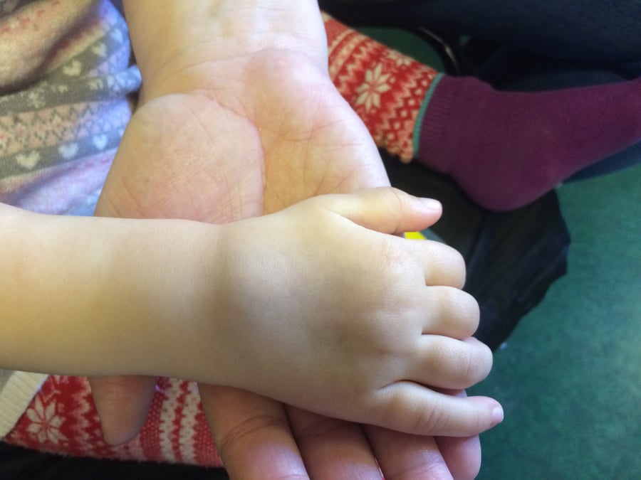 Svullna leder är jämte morgonstelhet och ledsmärta vanliga symtom vid barnreumatism, en sjukdom som kan leda till inskränkt rörelseförmåga. Foto: Akademiska sjukhuset