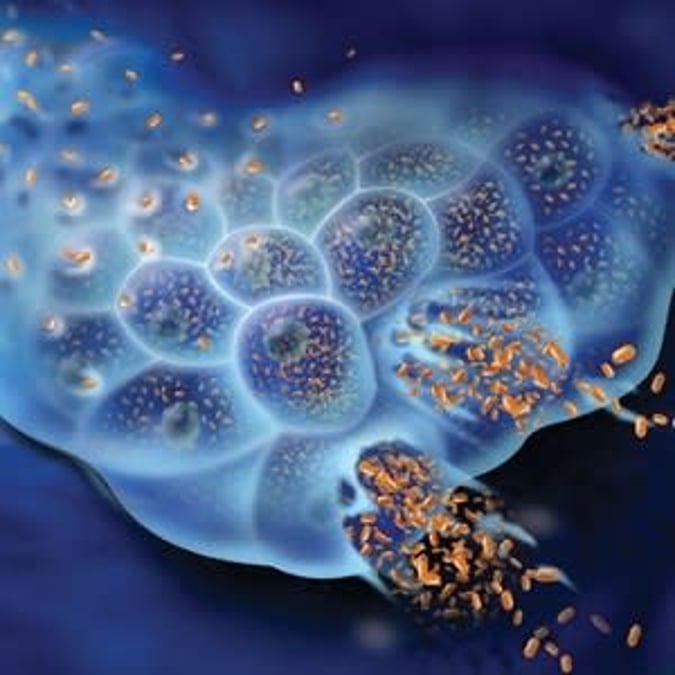 I en patientstudie på Akademiska testas för första gången i världen ett genmodifierat, onkolytiskt virus, mot neuroendokrina tumörer.