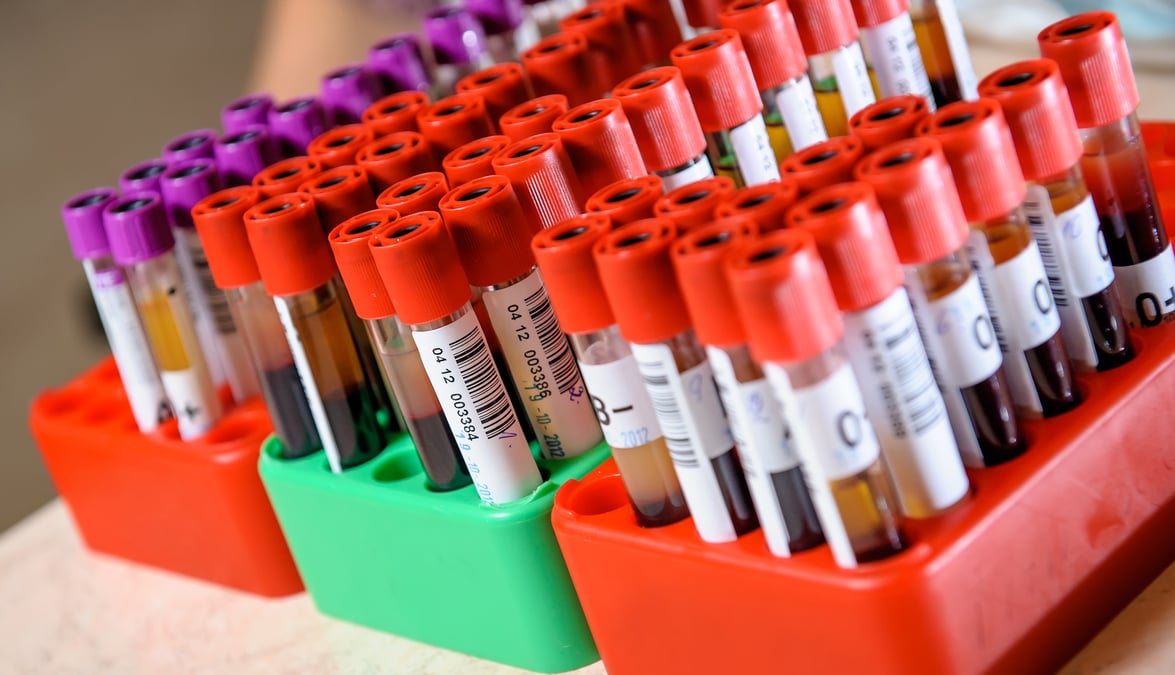 Akademiska sjukhuset medverkar i en europeisk studie där man utvärderar om ett relativt nytt läkemedel, som normalt ges till diabetiker för att sänka blodsockret, kan minska risken för hjärtsvikt och död efter hjärtinfarkt.