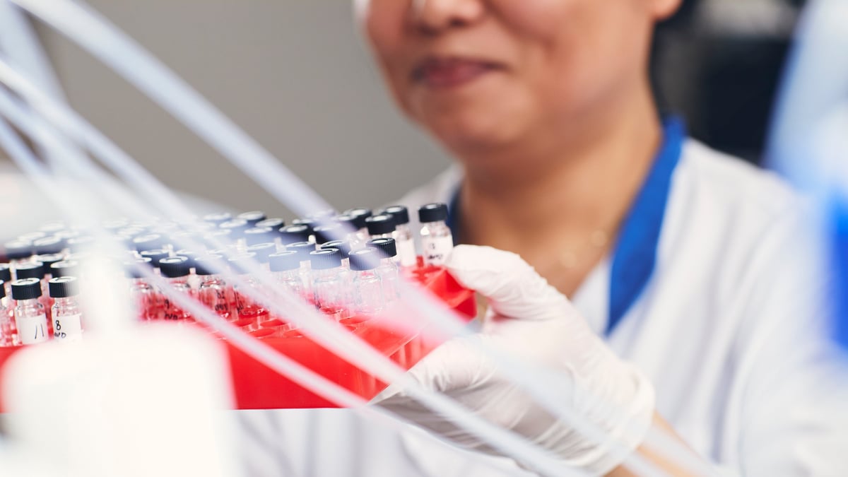 En studie vid Akademiska sjukhuset syftar till att utveckla biomarkörer som verktyg för mer träffsäker diagnos och behandling vid kronisk, inflammatorisk tarmsjukdom (IBD).