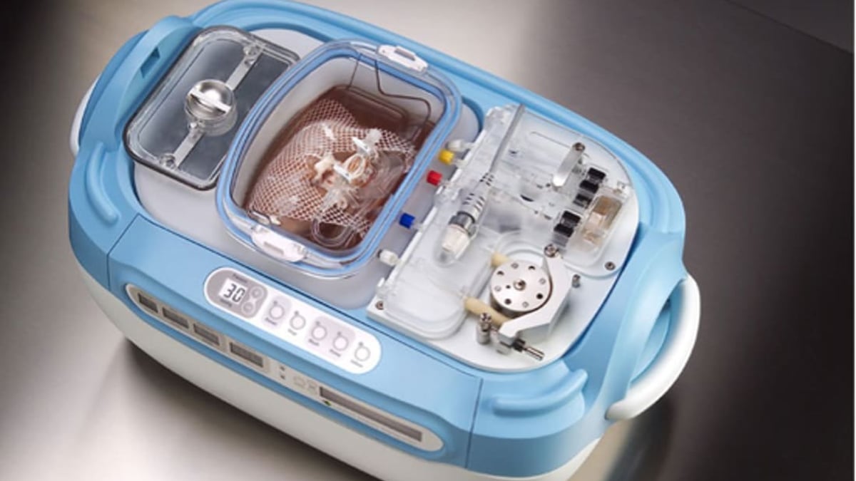 Efter organdonation förvaras den uttagna njuren i en perfusionsmaskin innan transplantationen. Njuren ligger i ett slutet system med kyld speciallösning där ett pulserande flöde genereras av maskinen.