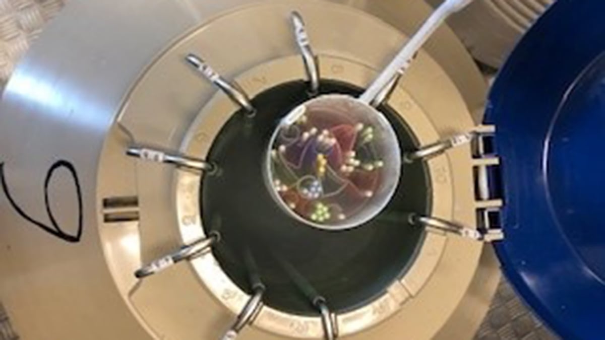 Akademiska sjukhuset efterlyser fler donatorer av ägg och spermier för att undvika att köerna till IVF-behandlingar ökar. På bilden syns en förvaringstank med flytande kväve som innehåller frysta spermier och ägg från donatorer.