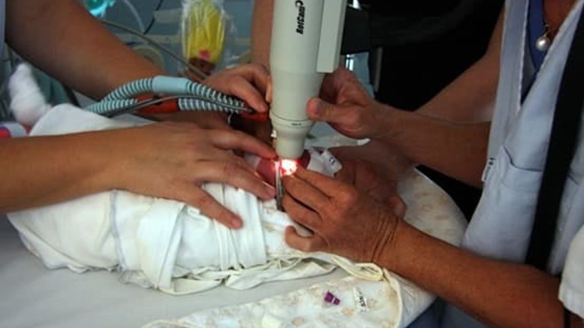 Ögonundersökning med vidvinkelkamera av ett nyfött barn.