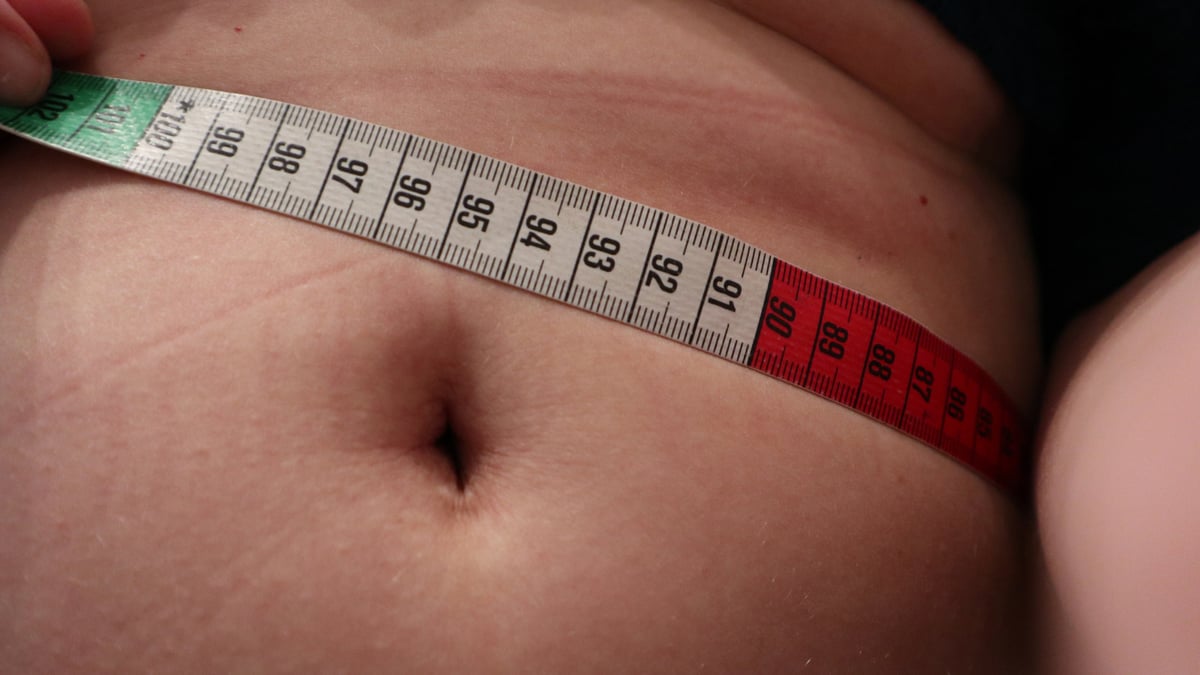 Niclas Abrahamsson, överläkare och sektionschef inom endokrinologi på Akademiska sjukhuset, har utnämnts till internationell expert inom övervikt/obesitas av Expertscape. Hans forskning är bl a inriktad på komplikationer efter överviktskirurgi. Foto: Genrebild (Mostphotos)