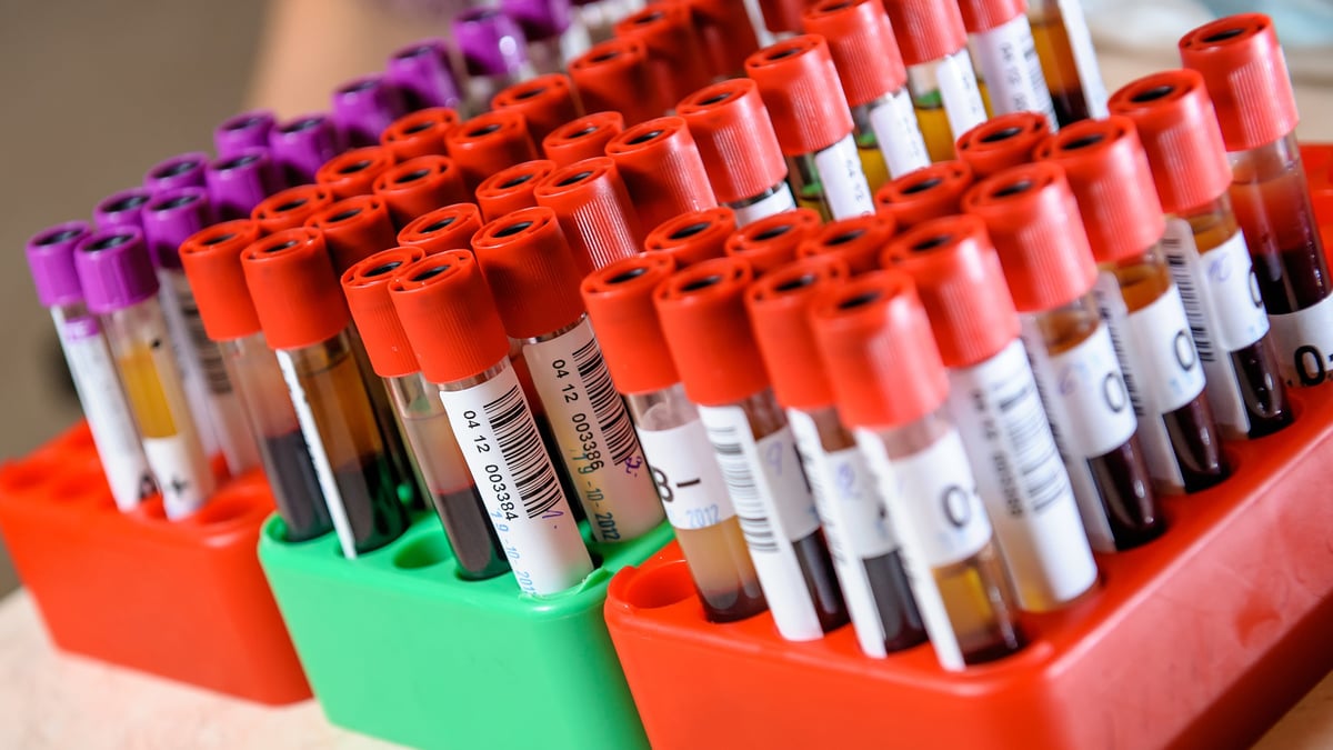 En studie ledd från Akademiska sjukhuset visar att det finns två tydliga undergrupper av patienter med Sjögrens syndrom som skiljer sig avseende genetisk bakgrund, förekomst av antikroppar och kliniska sjukdomsyttringar. Enligt forskare bör  man ta hänsyn till detta i läkemedelsstudier.