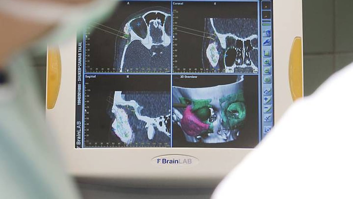 Kraniofacial kirurgi vid Akademiska är ett av tre områden på sjukhuset som nyligen ackrediterats av de europeiska referensnätverken (ERNs). Samarbetet syftar till att förbättra vården för patienter med sällsynta diagnoser.
