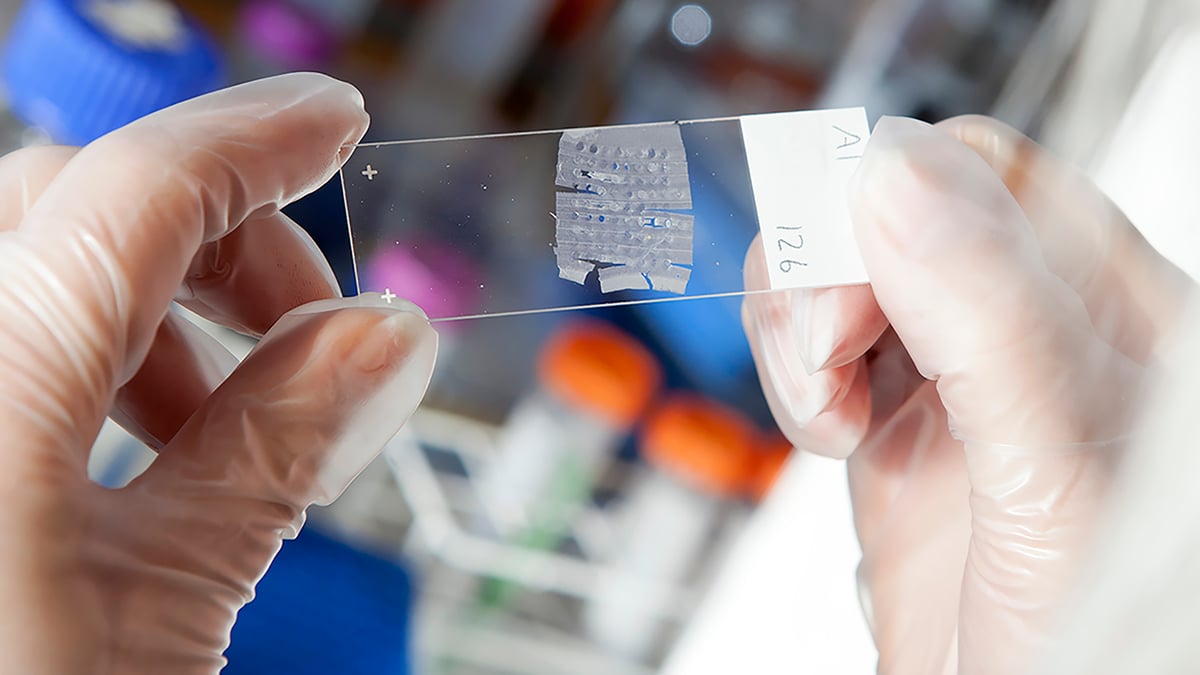 Region Uppsala/Akademiska sjukhuset och Uppsala universitet har inlett ett samarbete inom Precisionsmedicinskt centrum i Uppsala. Syftet är att säkerställa att fler patienter får ta del av precisionsdiagnostik och precisionsbehandling. Fotograf: Mikael Wallerstedt