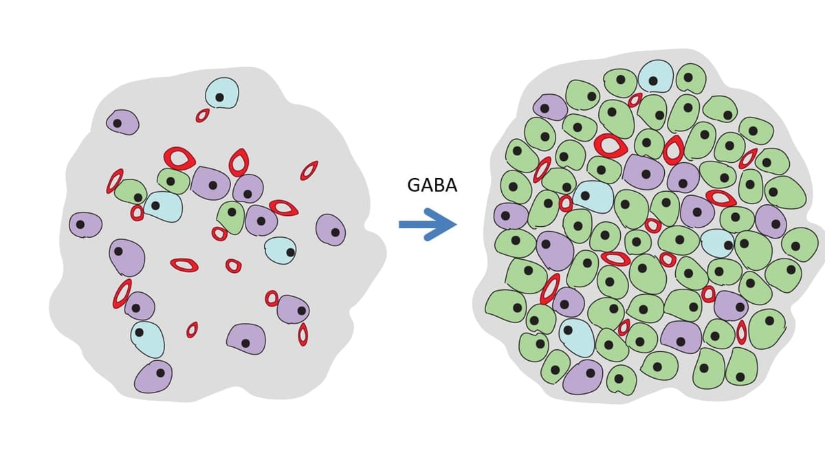 Vid typ 1 diabetes har närmast alla insulinproducerande beta-celler (i grönt) försvunnit i bukspottkörteln. Genom behandling med gammaaminosmörsyra (GABA) är förhoppningen att dessa ska återväxa genom celldelning och omvandling av andra celler.