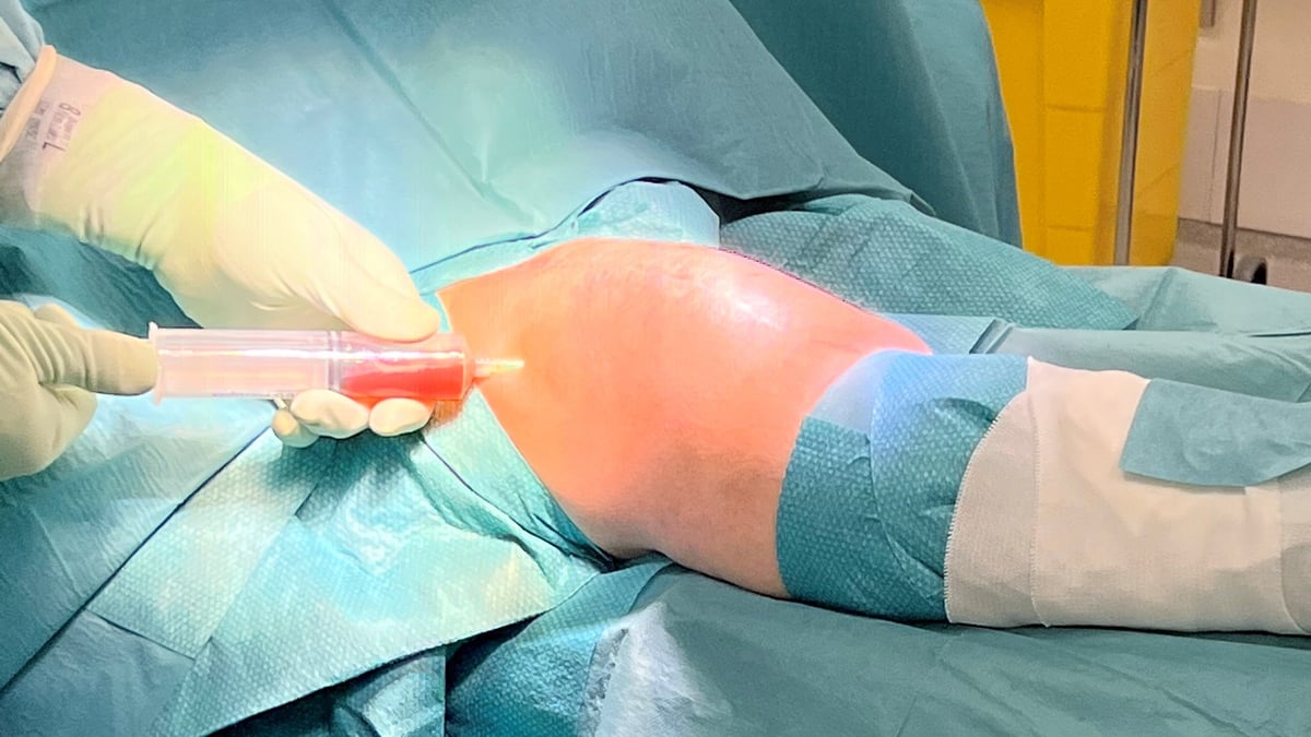 Rätt val av diagnostisk metod och antibiotikum har stor betydelse för att minska risken för infektion efter proteskirurgi. Det framgår av studier vid Akademiska sjukhuset/Uppsala universitet. Foto: Akademiska sjukhuset