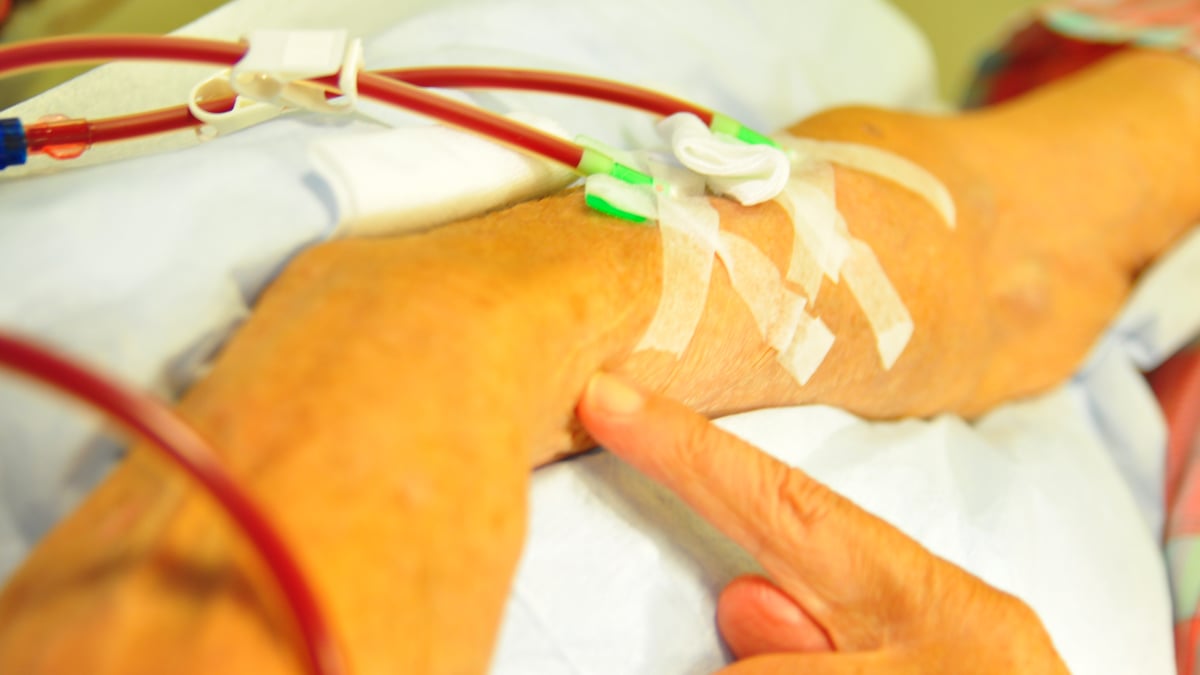 Vissa personer med avancerad kronisk njursvikt har behov av dialys eller njurtransplantation. I en ny studie vid bland annat Akademiska sjukhuset ska man utvärdera om/när patienter med avancerad njursvikt och förmaksflimmer ska rekommenderas behandling med blodförtunnande läkemedel. Idag saknas tillräcklig kunskap om detta. Fotograf: Christian Farman