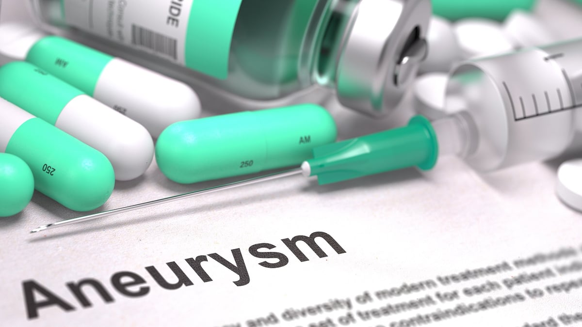 I en europeisk studie, ledd från Akademiska sjukhuset, utvärderas om diabetesläkemedlet metformin, kan bromsa tillväxten av aneurysm vid pulsåderbråck. Förhoppningen är att patienter med ett begynnande aneurysm ska slippa senare operation. Bild: Mostphotos