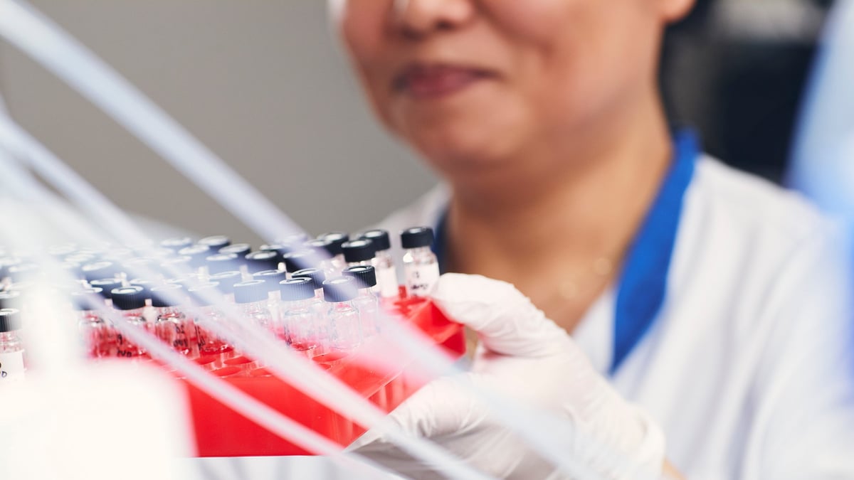 En studie vid Akademiska sjukhuset visar att personer med SLE som röker löper dubbelt så hög risk att drabbas av hjärtinfarkt jämfört med icke-rökare. För dem som ärvt en speciell genvariant, STAT4, från någon av sina föräldrar, innebär rökning en tredubblad risk.  Fotograf: Johan Alp