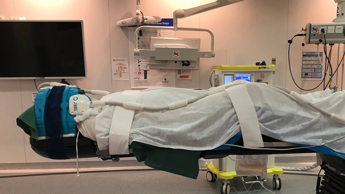 Djup hjärnstimulering (DBS) är en kompletterande behandling vid bland annat Parkinsons sjukdom. Akademiska sjukhuset är först i Norden med en ny DBS-modell som innebär att man med avancerade elektroder kan läsa av signaler från hjärnan samtidigt som patienten får behandling.