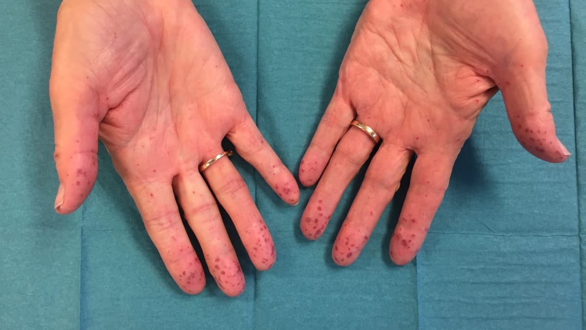 Adnan Lidian, överläkare på öron-näs- och halskliniken, Akademiska sjukhuset