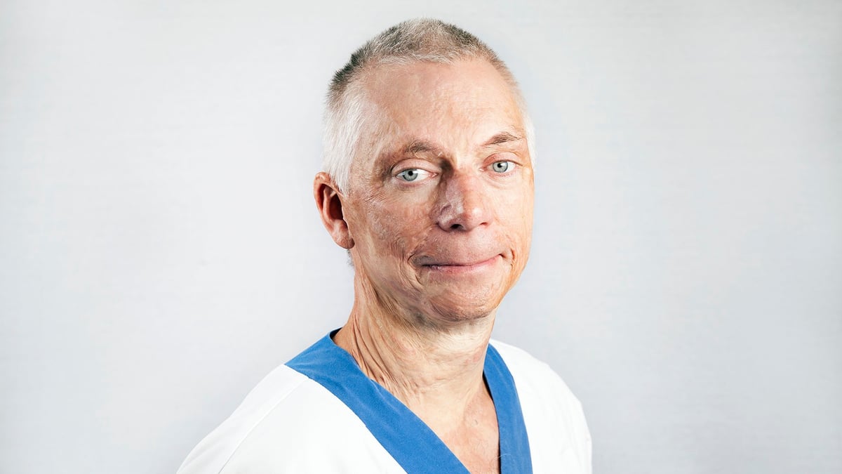 Fredrik Huss, överläkare och docent inom plastik- och käkkirurgi/brännskadecentrum, Akademiska sjukhuset