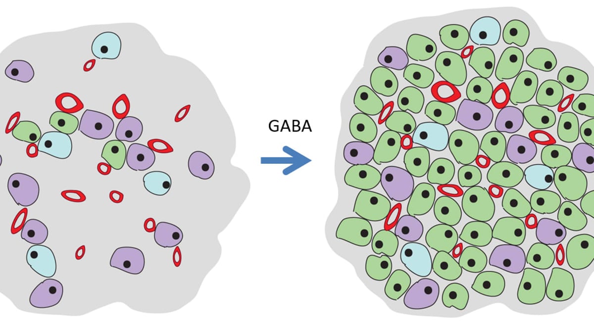 Vid typ 1 diabetes har närmast alla insulinproducerande beta-celler (i grönt) försvunnit i bukspottkörteln. Genom behandling med gammaaminosmörsyra (GABA) är förhoppningen att dessa ska återväxa genom celldelning och omvandling av andra celler.