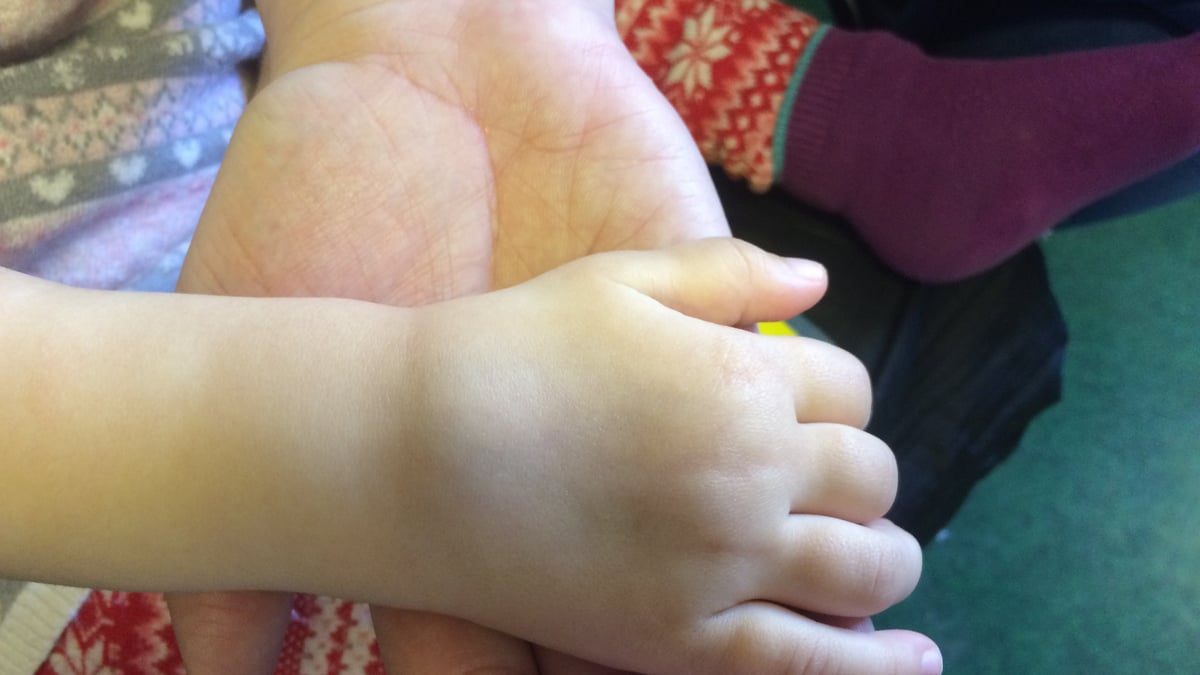 Svullna leder är jämte morgonstelhet och ledsmärta vanliga symtom vid barnreumatism, en sjukdom som kan leda till inskränkt rörelseförmåga. Foto: Akademiska sjukhuset