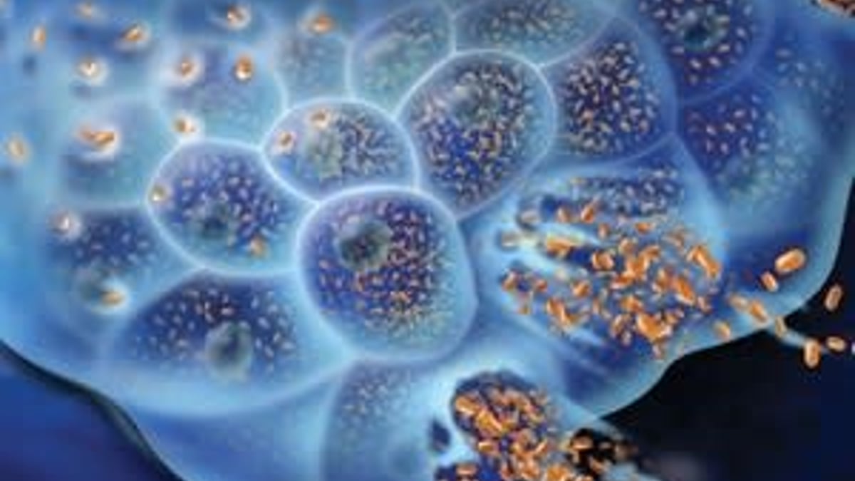 I en patientstudie på Akademiska testas för första gången i världen ett genmodifierat, onkolytiskt virus, mot neuroendokrina tumörer.