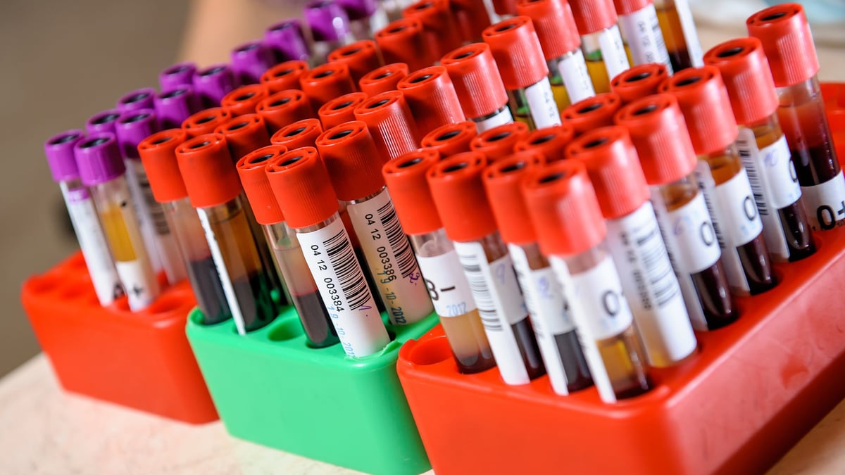 Akademiska sjukhuset medverkar i en europeisk studie där man utvärderar om ett relativt nytt läkemedel, som normalt ges till diabetiker för att sänka blodsockret, kan minska risken för hjärtsvikt och död efter hjärtinfarkt.