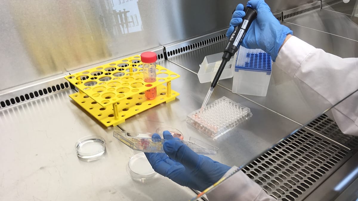 En ny diagnosmetod utvecklad av Uppsalaforskare gör det möjligt att redan vid diagnos förutsäga prognos och sjukdomsförlopp vid SLE. Detta förbättrar möjligheterna att anpassa behandlingen individuellt.