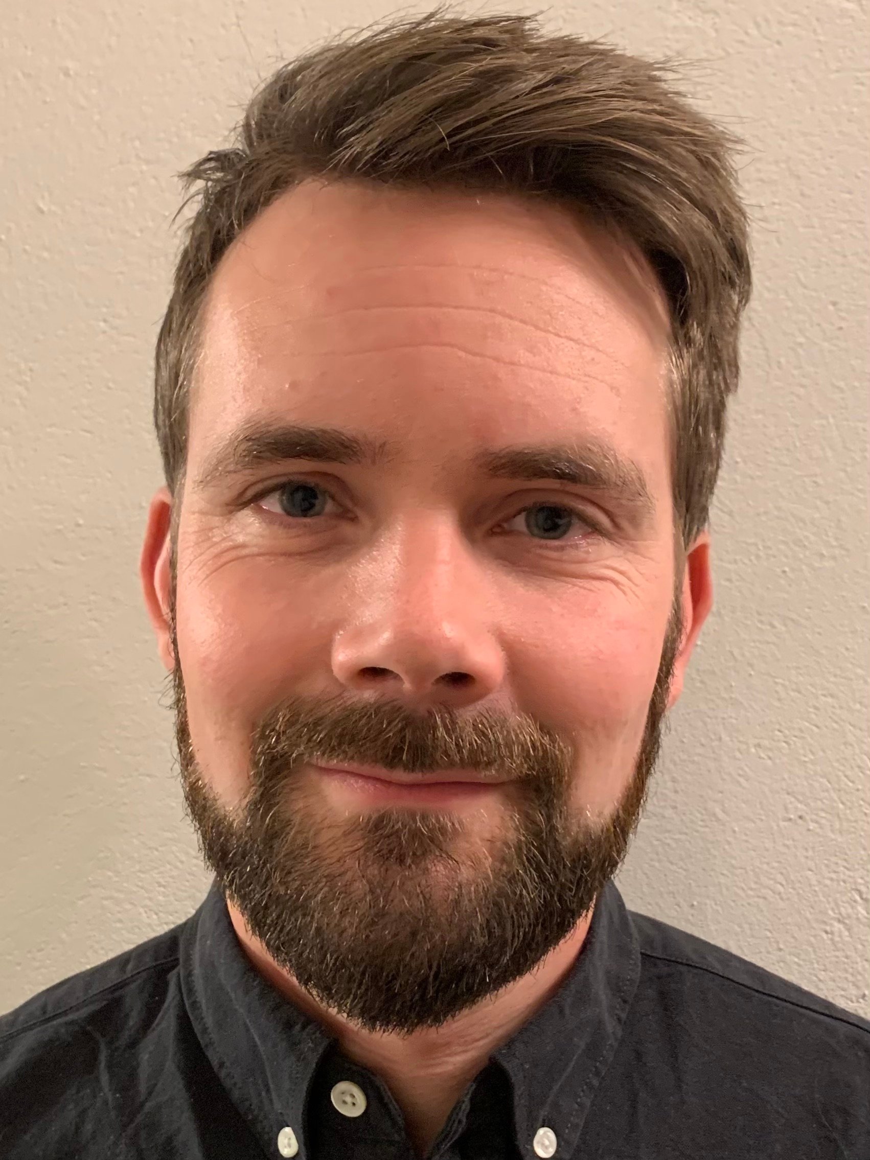 Fredrik Peyronson, ST-läkare i handkirurgi på Akademiska sjukhuset och forskare vid Uppsala universitet (Privat bild)