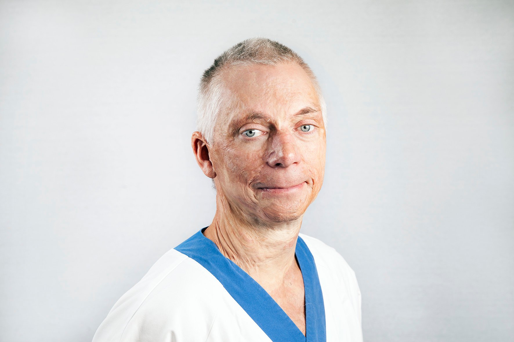 Fredrik Huss, överläkare brännskadecentrum, Akademiska sjukhuset
