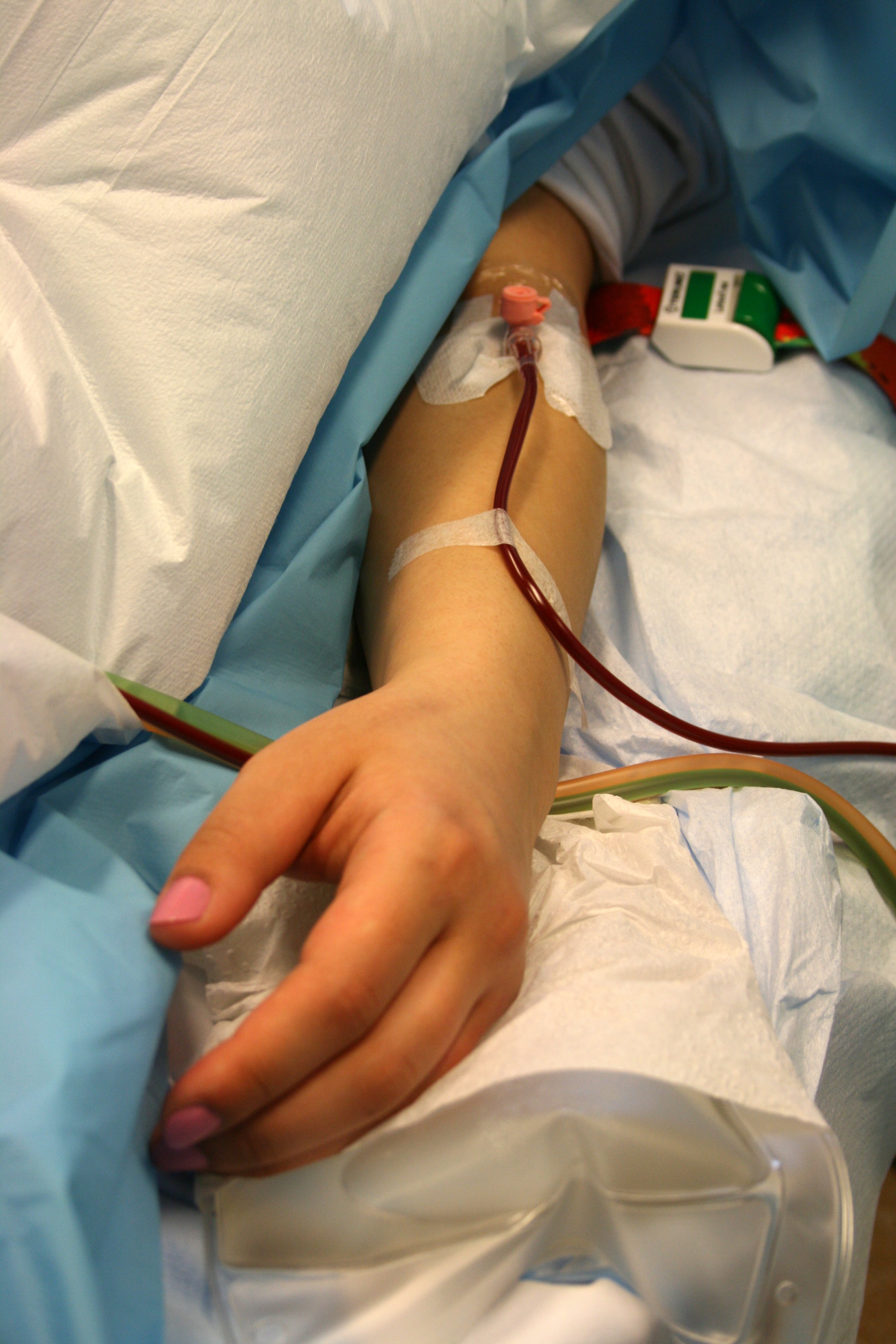 Skörd av stamceller inför transplantation vid MS
