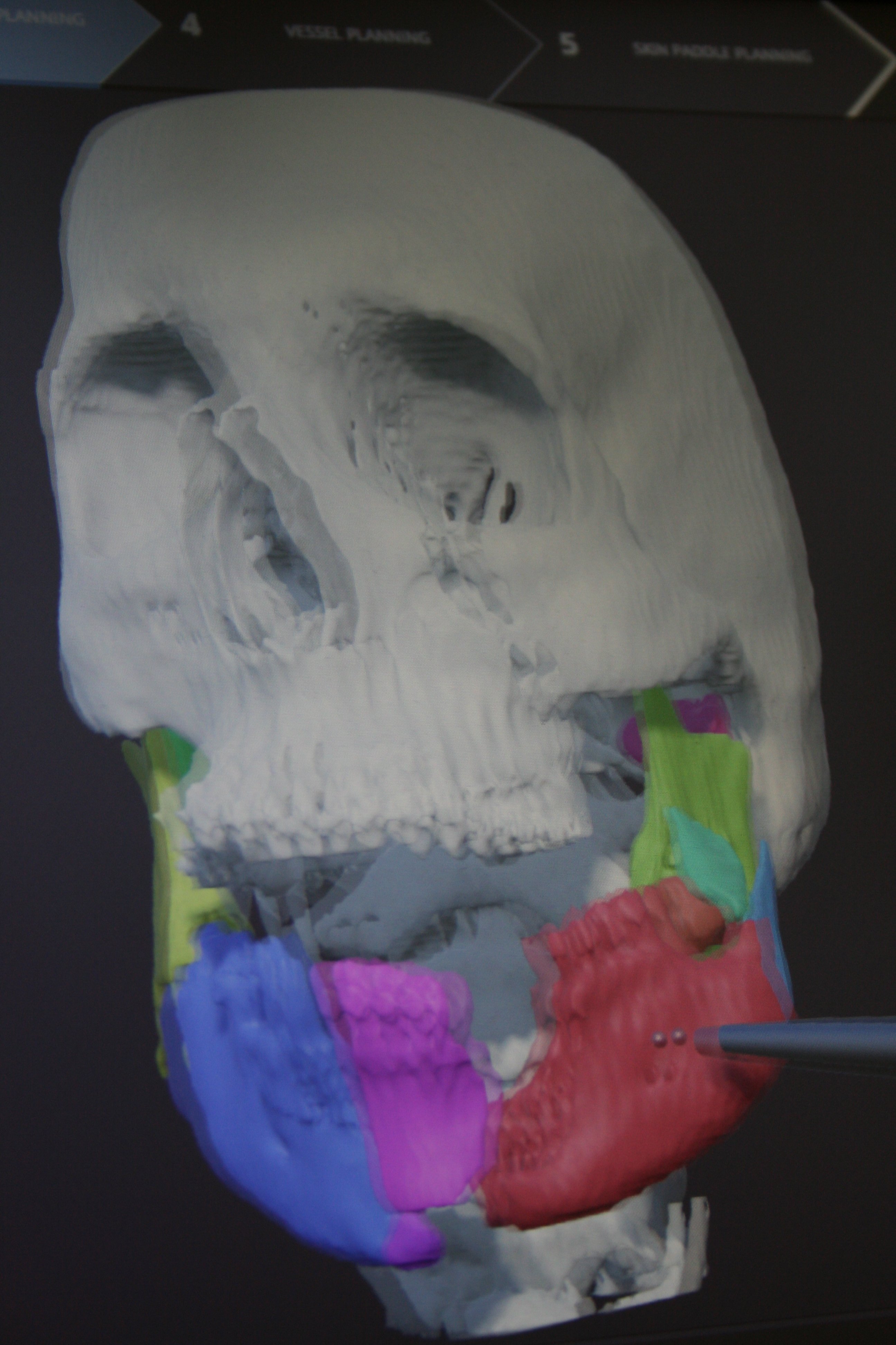 Kranium i 3D