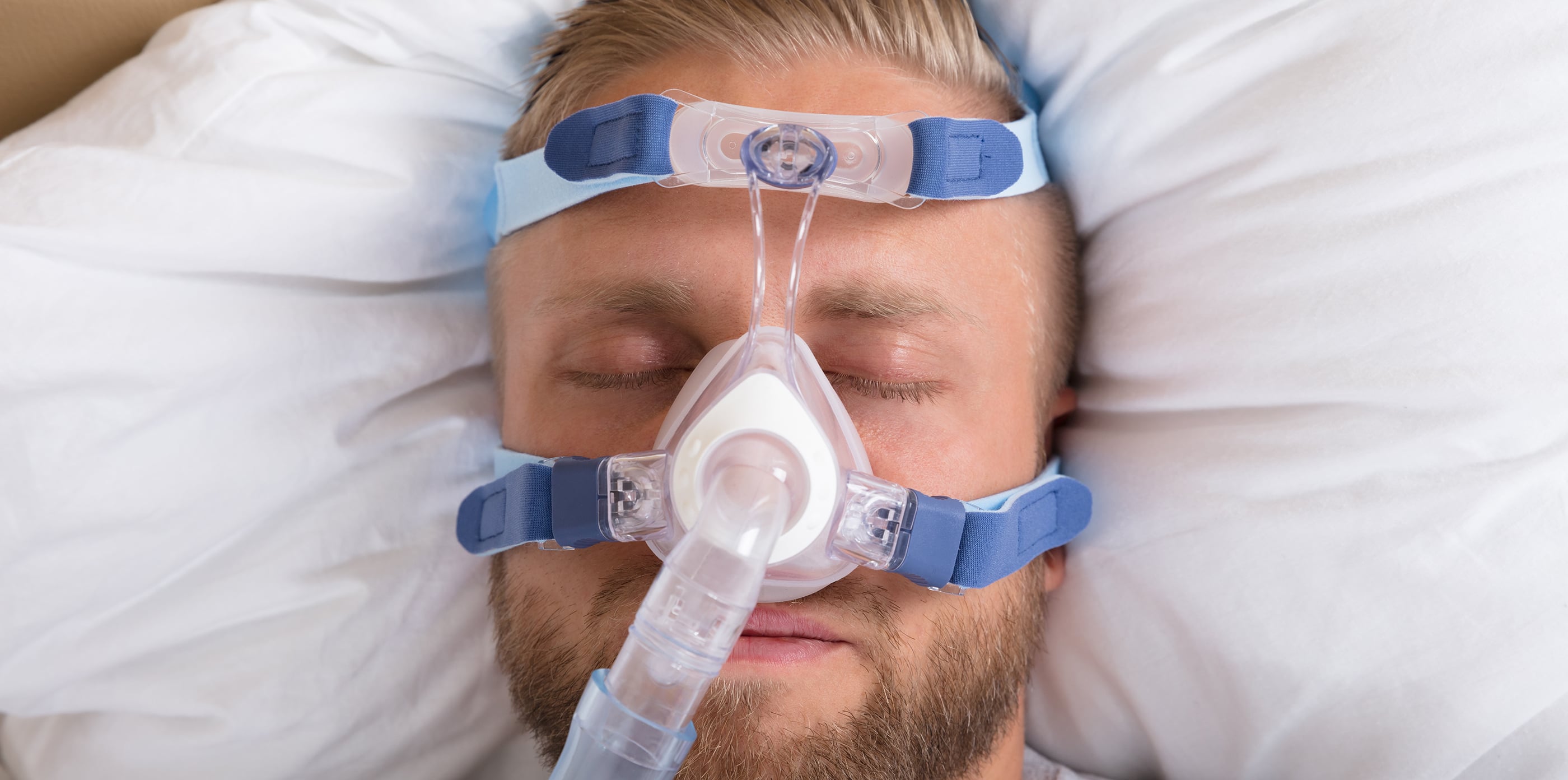 Sömnapné drabbar cirka tre procent av den vuxna befolkningen, med ökad risk för högt blodtryck, stroke och diabetes. Kopplingen till ökad cancerrisk har varit omdiskuterad. Nu visar en stor befolkningsstudie vid bland annat Akademiska sjukhuset/Uppsala universitet att det saknas belägg för ökad cancerrisk.