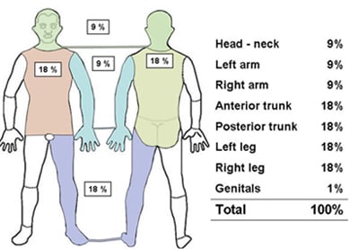 diagram utbredning av brännskada på kroppen