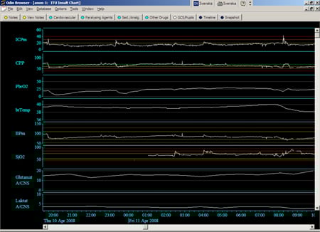 Ett datorsystem för insamling, analys och presentation av kliniska data.
