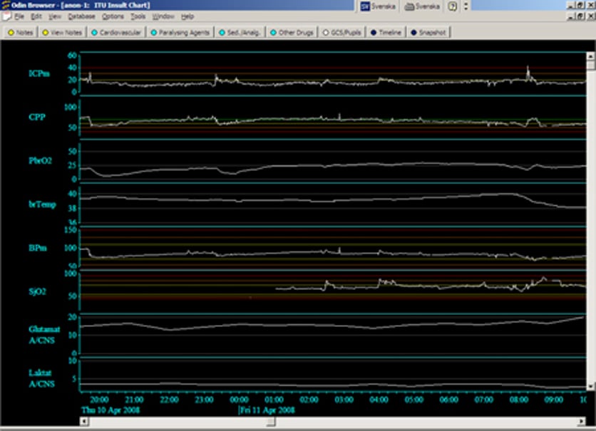 Ett datorsystem för insamling, analys och presentation av kliniska data.